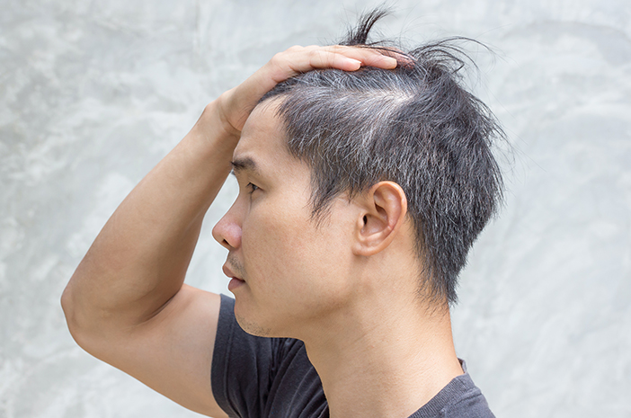 Umur Berapa Muncul Uban? Kenapa Rambut Uban Bisa Muncul di Usia Muda? Ini Dia Ceritanya! (2024)